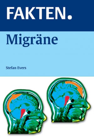 FAKTEN. Migräne - Evers, Stefan