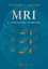 MRI - Sunder S. Rajan