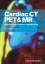 Cardiac CT, PET and MR - Vasken Dilsizian