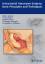 Intracranial Aneurysm Surgery: Basic Principles and Techniques  Duke Samson (u. a.)  Taschenbuch  Englisch  2011 - Samson, Duke