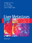 Liver Metastases - Herausgegeben von Vauthey, Jean-Nicolas Hoff, Paulo M. G. Audisio, Riccardo A. Poston, Graeme J.