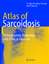 Atlas of Sarcoidosis - Violeta Mihailovic-Vucinic Om P. Sharma