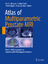 Atlas of Multiparametric Prostate MRI | With PI-RADS Approach and Anatomic-MRI-Pathological Correlation | Joan C. Vilanova (u. a.) | Buch | Englisch | 2017 | Springer-Verlag GmbH | EAN 9783319617855 - Vilanova, Joan C.