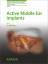 Active Middle Ear Implants K. Boeheim Buch Advances in Oto-Rhino-Laryngology Englisch 2010 - Boeheim, K.
