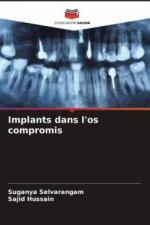 Implants dans l'os compromis
