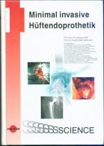 Minimal invasive Hüftendoprothetik