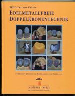 Edelmetallfreie Doppelkronentechnik - Kombinierte Prothese mit Doppelkronen und Modellguss