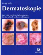 Dermatoskopie: Eine algorithmische Methode zur Diagnose pigmentierter Hautläsionen basierend auf der Musteranalyse