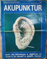 Akupunktur