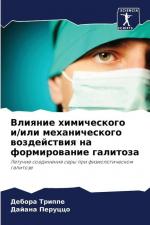 Vliqnie himicheskogo i/ili mehanicheskogo wozdejstwiq na formirowanie galitoza | Letuchie soedineniq sery pri fiziologicheskom galitoze | Debora Trippe (u. a.) | Taschenbuch | Paperback | Russisch