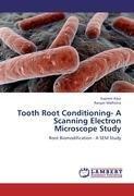 Tooth Root Conditioning- A Scanning Electron Microscope Study