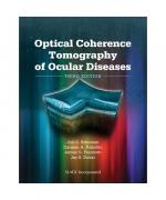 Joel S. Schuman: Optical Coherence Tomog Joel S. Schuman: Optical Coherence Tomog