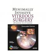 Minimally Invasive Vitreous Surgery: 20 Gauge to 27 Gauge