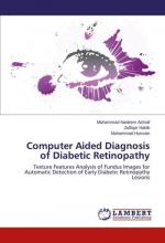 Computer Aided Diagnosis of Diabetic Retinopathy