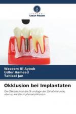 Waseem Ul Ayoub: Okklusion bei Implantat