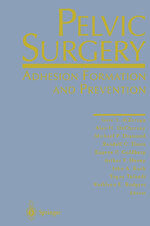 ISBN 9781461273165: Pelvic Surgery