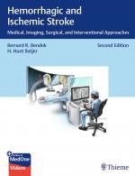 ISBN 9781684200436: Hemorrhagic and Ischemic Stroke