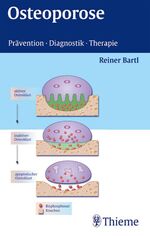 ISBN 9783131057518: Osteoporose – Prävention - Diagnostik - Therapie