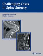 ISBN 9783131419415: Challening Cases in Spine Surgery