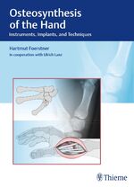 ISBN 9783132038110: Osteosynthesis of the Hand – Instruments, Implants, and Techniques