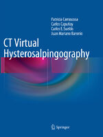 ISBN 9783319355412: CT Virtual Hysterosalpingography | Patricia Carrascosa (u. a.) | Taschenbuch | Paperback | xiii | Englisch | 2017 | Springer International Publishing | EAN 9783319355412