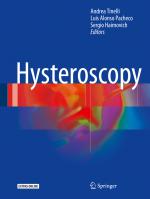 ISBN 9783319575582: Hysteroscopy