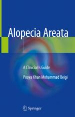 ISBN 9783319721330: Alopecia Areata – A Clinician's Guide