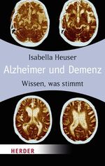 ISBN 9783451061899: Alzheimer und Demenz - Wissen, was stimmt