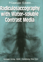 ISBN 9783540085591: Radiculosaccography with Water-soluble Contrast Media