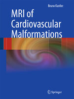 ISBN 9783540307013: MRI of Cardiovascular Malformations