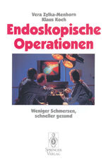 ISBN 9783540593270: Endoskopische Operationen - Weniger Schmerzen, schneller gesund