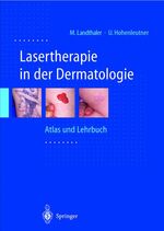 ISBN 9783540653639: Lasertherapie in der Dermatologie: Atlas und Lehrbuch Landthaler, Michael; Hohenleutner, Ulrich and Braun-Falco, O.