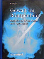 ISBN 9783609628707: Gewalt im Röntgenbild: Befunde zu Krieg, Folter und Verbrechen (ecomed Medizin & Biowissenschaften) Vogel, H