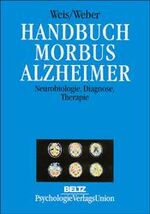 ISBN 9783621273732: Handbuch Morbus Alzheimer