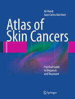 Atlas of Skin Cancers - Practical Guide to Diagnosis and Treatment