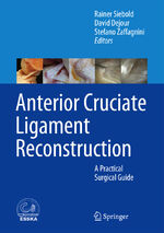 ISBN 9783642453489: Anterior Cruciate Ligament Reconstruction – A Practical Surgical Guide