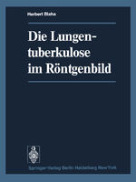 ISBN 9783642491801: Die Lungentuberkulose im Röntgenbild