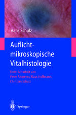 ISBN 9783642626692: Auflichtmikroskopische Vitalhistologie – Dermatologischer Leitfaden