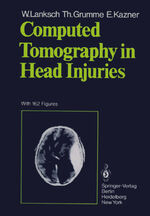 ISBN 9783642674235: Computed Tomography in Head Injuries