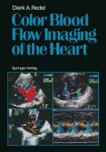 ISBN 9783642711749: Color Blood Flow Imaging of the Heart