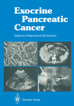Hughes Baumel: Exocrine Pancreatic Cance Hughes Baumel: Exocrine Pancreatic Cance