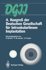 ISBN 9783642760839: 4. Kongreß der Deutschen Gesellschaft für Intraokularlinsen Implantation - 6. bis 7. April 1990, Essen