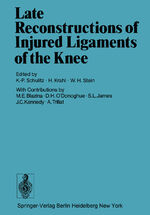 ISBN 9783642872761: Late Reconstructions of Injured Ligaments of the Knee