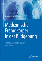 ISBN 9783662472958: Medizinische Fremdkörper in der Bildgebung - Thorax, Abdomen, Gefäße und Kinder