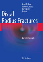 ISBN 9783662512630: Distal Radius Fractures – Current Concepts