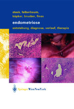 ISBN 9783709171967: Endometriose – Entstehung, Diagnose, Verlauf und Therapie