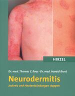 Neurodermitis - Juckreiz und Hautentzündungen stoppen