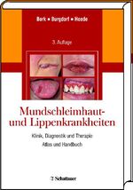 ISBN 9783794524860: Mundschleimhaut- und Lippenkrankheiten - Klinik, Diagnostik und Therapie Atlas und Handbuch