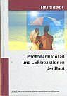 Photodermatosen und Lichtreaktionen der Haut