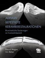 ISBN 9783876523682: Adhäsiv befestigte Keramikrestaurationen im Frontzahnbereich – Biomimetische Sanierungen im Frontzahnbereich